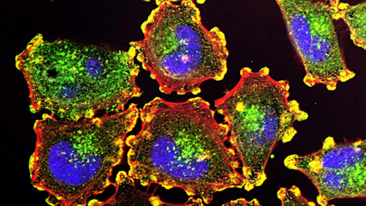 cells with fluorescence