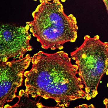 cells with fluorescence