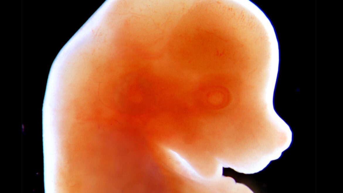 a human embryo early stage