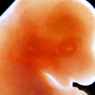 a human embryo early stage
